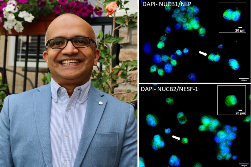 USask scientist Dr. Suraj Unniappan (left). At right is a micrograph image showing nesfatin-1-like peptide (top, green) and nesfatin-1 (bottom, green) in human liver cells. (Credit: submitted.)